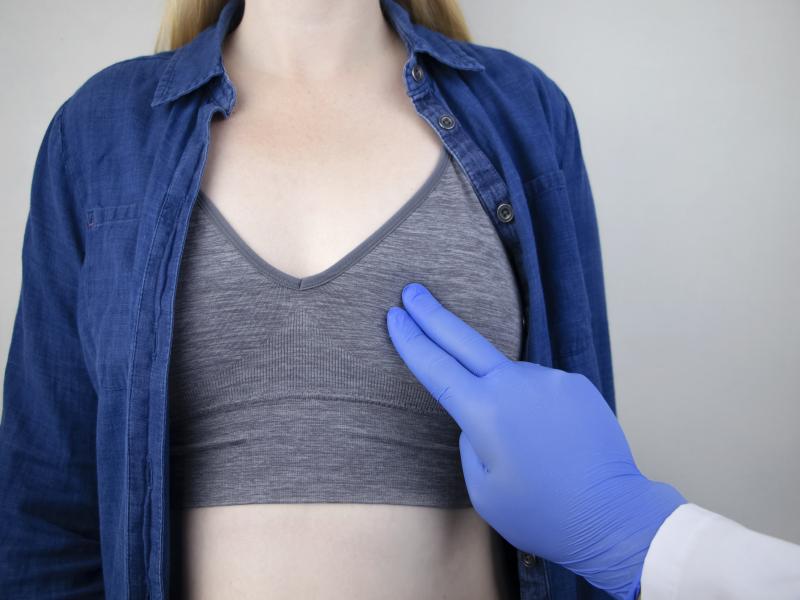 乳腺癌個性化用藥解決方案